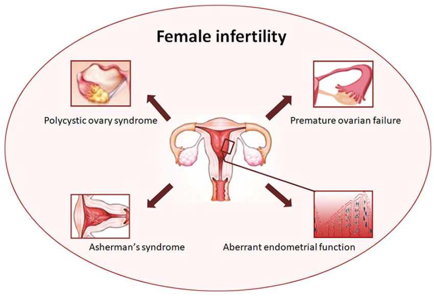 The-common-types-of-female-infertility-issues